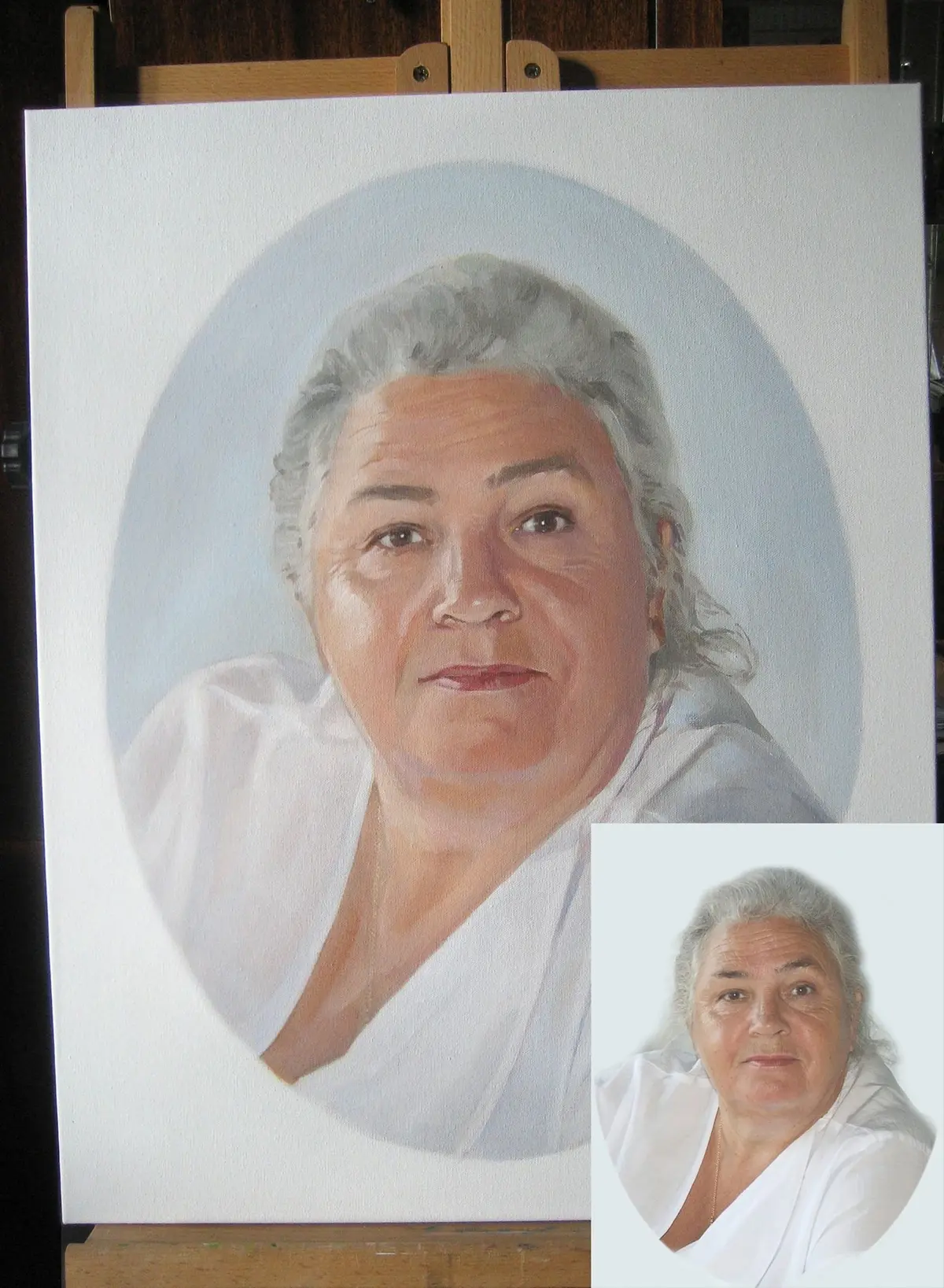 Paveikslėlis Kakta, nosis ir skruostas s34635